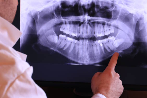Best Broken or Chipped Tooth Repair in Ocean Gate, NJ
