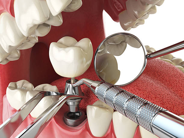 Best Broken or Chipped Tooth Repair in Ocean Gate, NJ